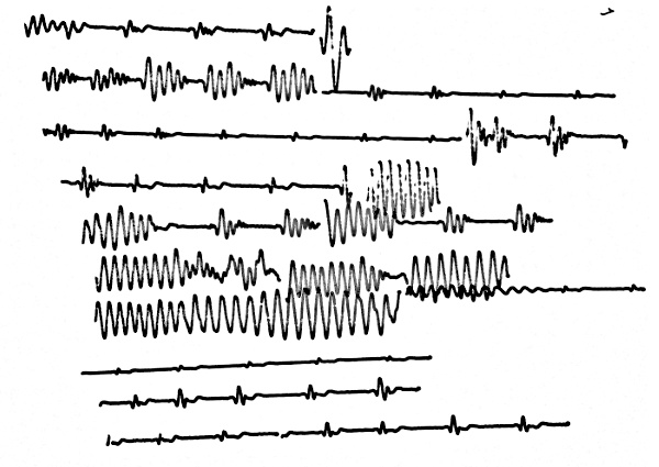 Lines at various settings